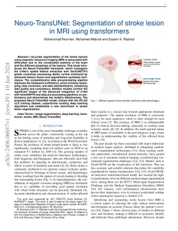 Neuro-TransUNet: Segmentation of stroke lesion in MRI using transformers