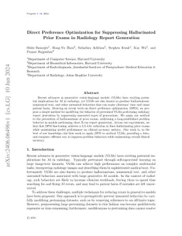 Direct Preference Optimization for Suppressing Hallucinated Prior Exams
  in Radiology Report Generation