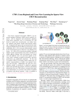 C^2RV: Cross-Regional and Cross-View Learning for Sparse-View CBCT
  Reconstruction