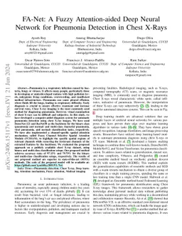 FA-Net: A Fuzzy Attention-aided Deep Neural Network for Pneumonia
  Detection in Chest X-Rays