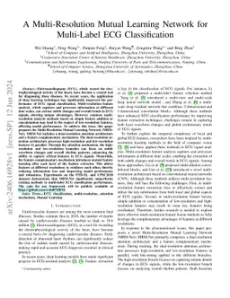 A Multi-Resolution Mutual Learning Network for Multi-Label ECG
  Classification