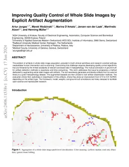 Improving Quality Control of Whole Slide Images by Explicit Artifact
  Augmentation