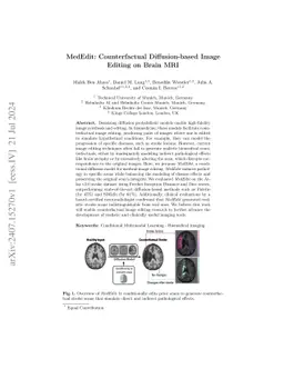MedEdit: Counterfactual Diffusion-based Image Editing on Brain MRI