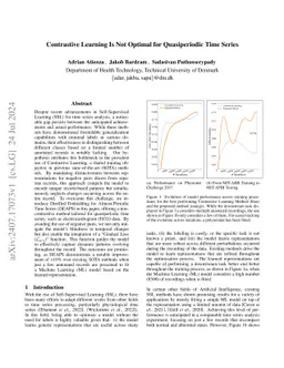 Contrastive Learning Is Not Optimal for Quasiperiodic Time Series