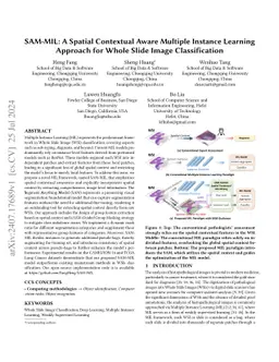SAM-MIL: A Spatial Contextual Aware Multiple Instance Learning Approach
  for Whole Slide Image Classification