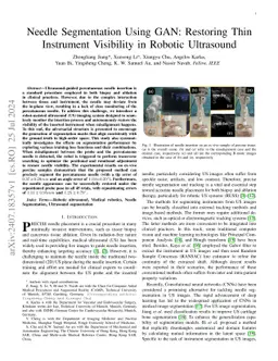 Needle Segmentation Using GAN: Restoring Thin Instrument Visibility in
  Robotic Ultrasound