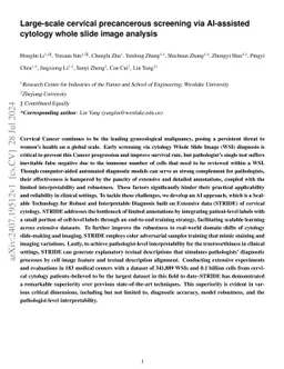 Large-scale cervical precancerous screening via AI-assisted cytology
  whole slide image analysis