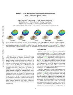 SALVE: A 3D Reconstruction Benchmark of Wounds from Consumer-grade Videos