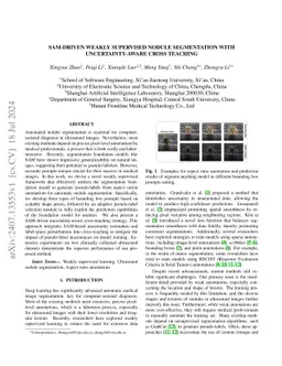 SAM-Driven Weakly Supervised Nodule Segmentation with Uncertainty-Aware
  Cross Teaching