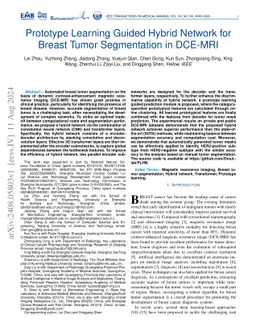 Prototype Learning Guided Hybrid Network for Breast Tumor Segmentation
  in DCE-MRI