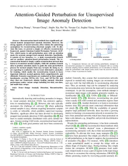 Not All Regions Are Equal: Attention-Guided Perturbation Network for Industrial Anomaly Detection