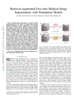 Retrieval-augmented Few-shot Medical Image Segmentation with Foundation Models