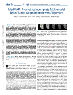 MedMAP: Promoting Incomplete Multi-modal Brain Tumor Segmentation with
  Alignment