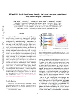 R2GenCSR: Retrieving Context Samples for Large Language Model based
  X-ray Medical Report Generation