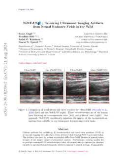 NeRF-US: Removing Ultrasound Imaging Artifacts from Neural Radiance
  Fields in the Wild