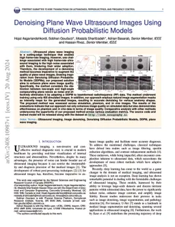 Denoising Plane Wave Ultrasound Images Using Diffusion Probabilistic
  Models