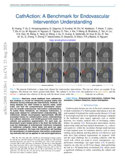 CathAction: A Benchmark for Endovascular Intervention Understanding