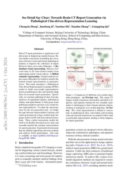 See Detail Say Clear: Towards Brain CT Report Generation via
  Pathological Clue-driven Representation Learning