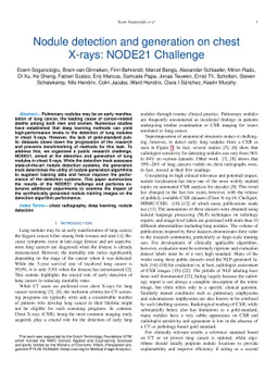 Nodule detection and generation on chest X-rays: NODE21 Challenge