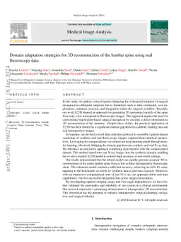 Domain adaptation strategies for 3D reconstruction of the lumbar spine
  using real fluoroscopy data