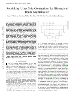 Rethinking U-net Skip Connections for Biomedical Image Segmentation