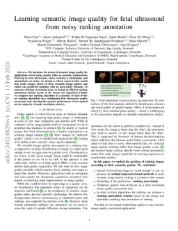 Learning semantic image quality for fetal ultrasound from noisy ranking
  annotation