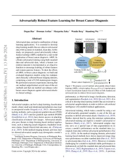 Adversarially Robust Feature Learning for Breast Cancer Diagnosis