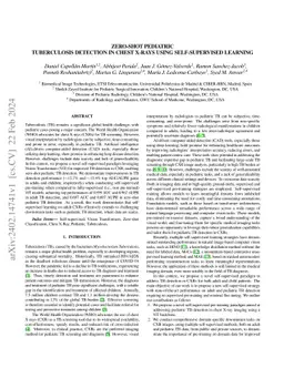 Zero-Shot Pediatric Tuberculosis Detection in Chest X-Rays using
  Self-Supervised Learning