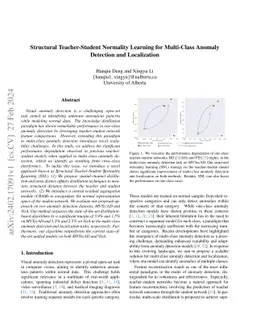 Structural Teacher-Student Normality Learning for Multi-Class Anomaly
  Detection and Localization