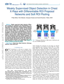 Weakly Supervised Object Detection in Chest X-Rays with Differentiable
  ROI Proposal Networks and Soft ROI Pooling