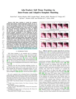 Ada-Tracker: Soft Tissue Tracking via Inter-Frame and Adaptive-Template
  Matching