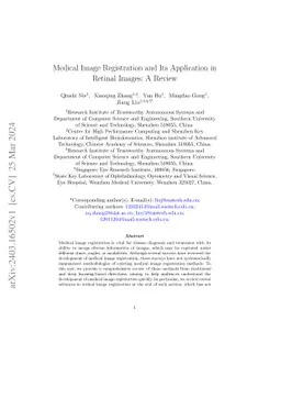 Medical Image Registration and Its Application in Retinal Images: A
  Review