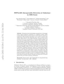 PIPNet3D: Interpretable Detection of Alzheimer in MRI Scans