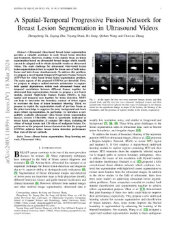 A Spatial-Temporal Progressive Fusion Network for Breast Lesion
  Segmentation in Ultrasound Videos