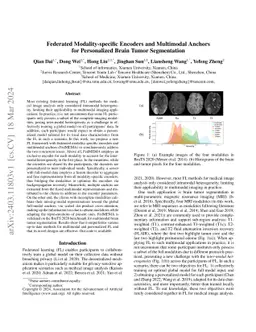 Federated Modality-specific Encoders and Multimodal Anchors for
  Personalized Brain Tumor Segmentation