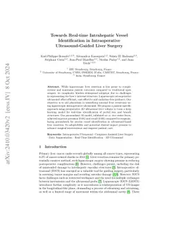 Towards Real-time Intrahepatic Vessel Identification in Intraoperative
  Ultrasound-Guided Liver Surgery