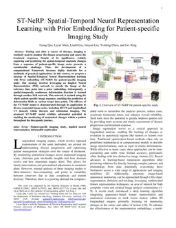 ST-NeRP: Spatial-Temporal Neural Representation Learning with Prior
  Embedding for Patient-specific Imaging Study