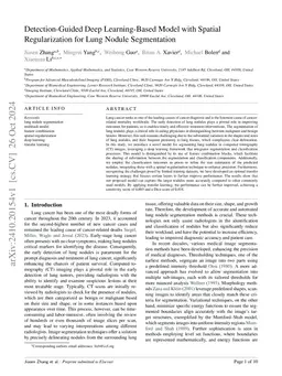 Detection-Guided Deep Learning-Based Model with Spatial Regularization
  for Lung Nodule Segmentation