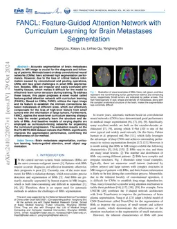 FANCL: Feature-Guided Attention Network with Curriculum Learning for
  Brain Metastases Segmentation