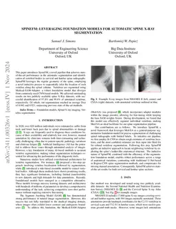 SpineFM: Leveraging Foundation Models for Automatic Spine X-ray Segmentation