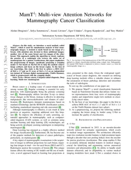 MamT$^4$: Multi-view Attention Networks for Mammography Cancer
  Classification