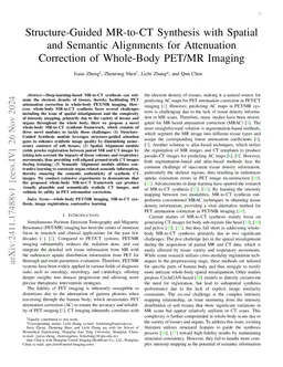 Structure-Guided MR-to-CT Synthesis with Spatial and Semantic Alignments
  for Attenuation Correction of Whole-Body PET/MR Imaging