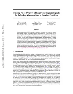 Finding "Good Views" of Electrocardiogram Signals for Inferring
  Abnormalities in Cardiac Condition