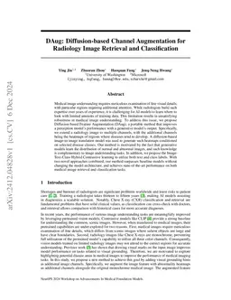 DAug: Diffusion-based Channel Augmentation for Radiology Image Retrieval
  and Classification
