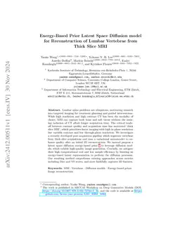Energy-Based Prior Latent Space Diffusion model for Reconstruction of
  Lumbar Vertebrae from Thick Slice MRI
