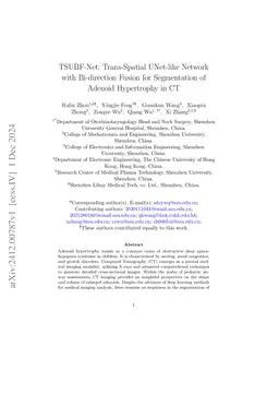 TSUBF-Net: Trans-Spatial UNet-like Network with Bi-direction Fusion for
  Segmentation of Adenoid Hypertrophy in CT