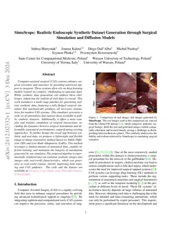 SimuScope: Realistic Endoscopic Synthetic Dataset Generation through
  Surgical Simulation and Diffusion Models