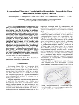 Segmentation of Muscularis Propria in Colon Histopathology Images Using Vision Transformers for Hirschsprung's Disease