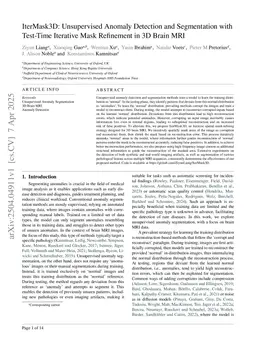 IterMask3D: Unsupervised Anomaly Detection and Segmentation with Test-Time Iterative Mask Refinement in 3D Brain MR