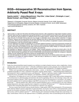 IXGS-Intraoperative 3D Reconstruction from Sparse, Arbitrarily Posed Real X-rays